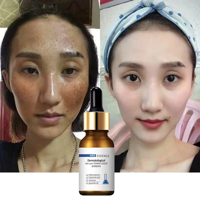 30ML valgendamine FACE serum näonaha seerumi c-vitamiini naha hooldus naiste ilu toodete seerumi korea